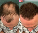 Camuflagem Capilar Profissional FixHair